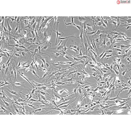 Mouse Lymphatic Fibroblasts from C57BL/6