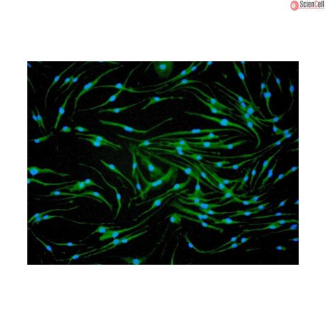 C57BL/6 Mouse Bone Marrow Derived Macrophages