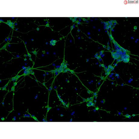 <strong>NEW!</strong> Mouse Neurons-forebrain from C57BL/6