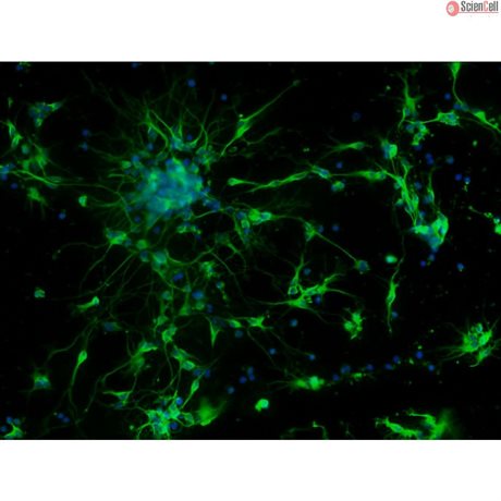 Mouse Neurons-forebrain