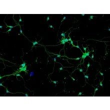 Mouse Neurons-hippocampal from C57BL/6