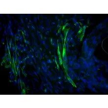 C57BL/6, Mouse Neurons-raphe, Passage 0