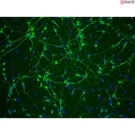 C57BL/6, Mouse Neurons-spinal cord, Passage 0