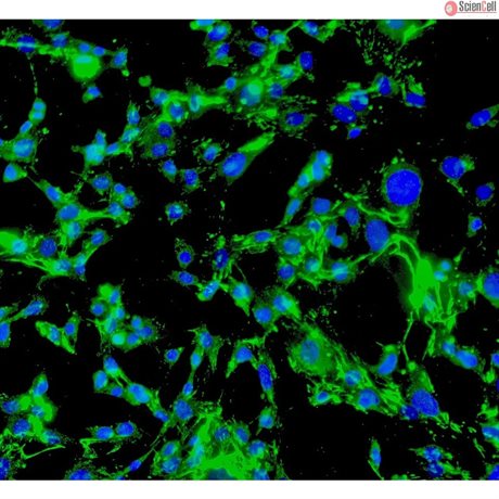 Mouse Perineurial Fibroblasts from C57BL/6