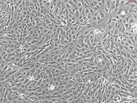 Porcine Retinal Pigment Epithelial Cells