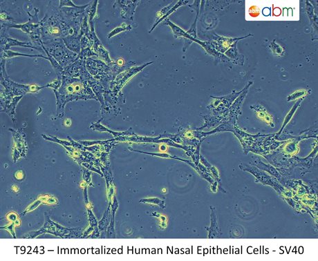 Immortalized Human Nasal Epithelial Cells - SV40