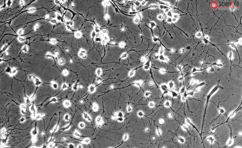 Rat Neurons-cortical