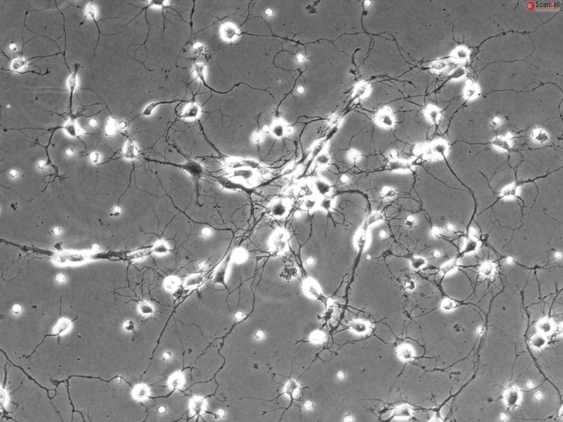 Rat Cerebellar Granule Cells