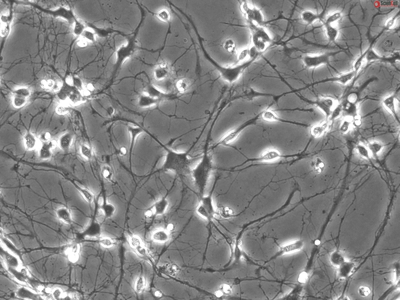 Rat Neurons-striatal