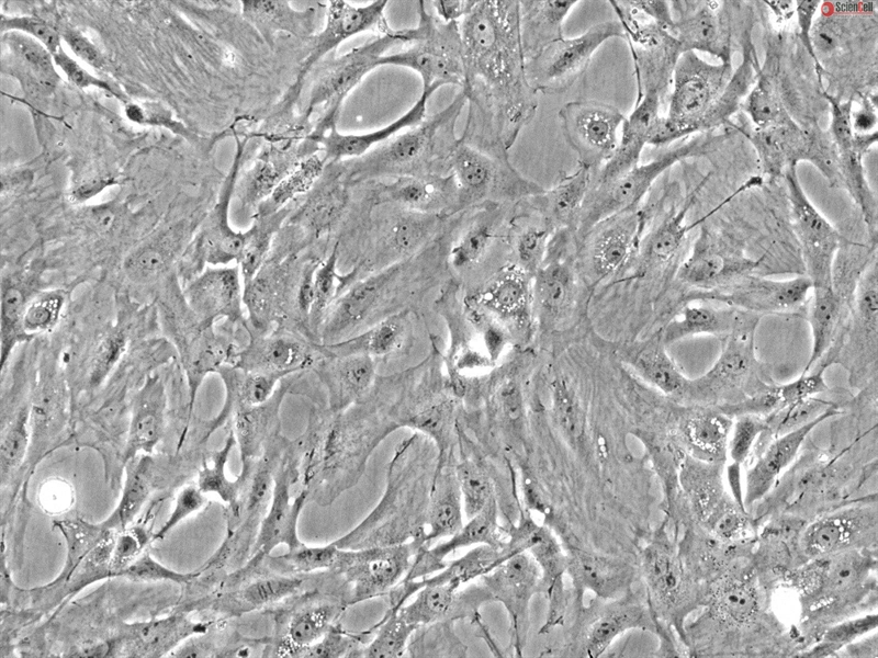 Rat Pulmonary Fibroblasts