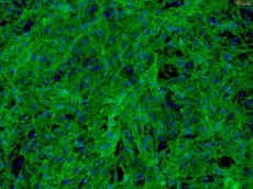 Rat Mesenchymal Stem Cells-bone marrow