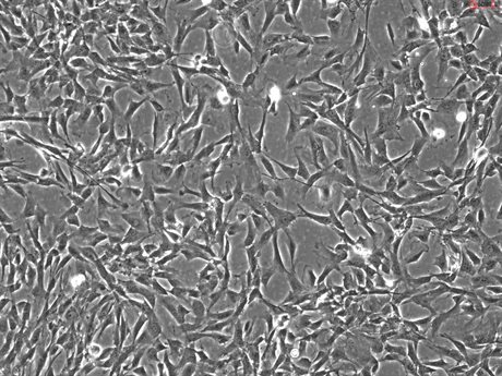 Rabbit Astrocytes