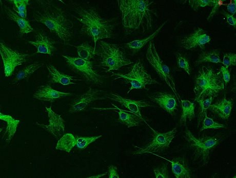 Rabbit Iris Pigment Epithelial Cells