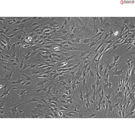 Rat Lymphatic Fibroblasts