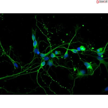Rat Neurons-midbrain