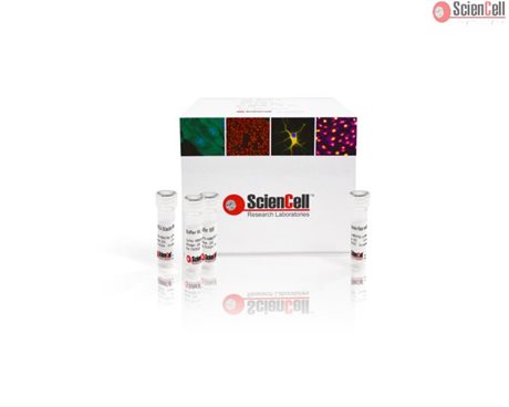 <b>NEW!<b/> Single Cell Whole Genome Amplification Kit