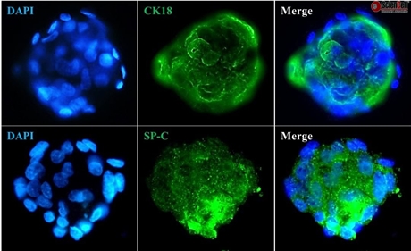 3D Culture of Human Primary Pulmonary Alveolar Epithelial Cell Spheroids