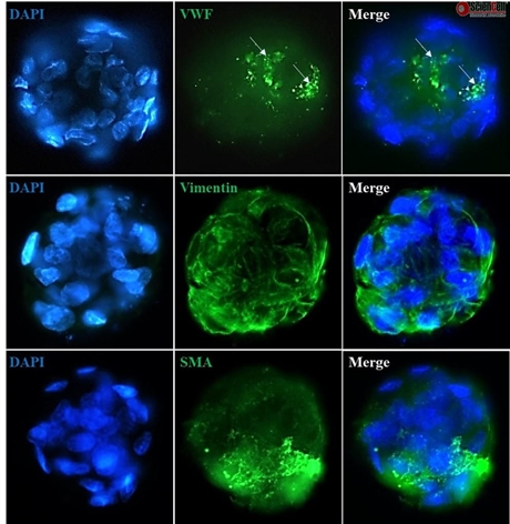 3D Culture of Hepatic Stellate-Endothelial Cell Spheroids