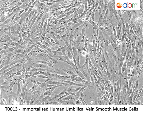 Immortalized Human Umbilical Vein Smooth Muscle Cells
