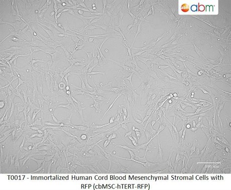 Immortalized Human Cord Blood Mesenchymal Stromal Cells with RFP (cbMSC-hTERT-RFP)