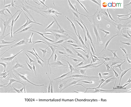 Immortalized Human Chondrocytes - Ras