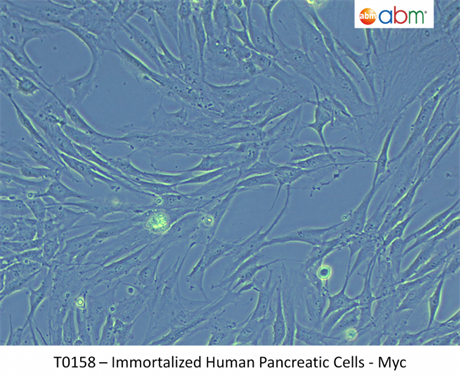 Immortalized Human Pancreatic Cells - Myc
