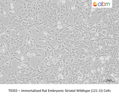 Immortalized Rat Embryonic Striatal Wildtype (121-1I) Cells