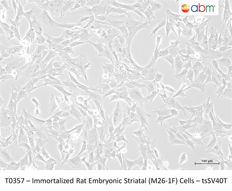 Immortalized Rat Embryonic Striatal (M26-1F) Cells - tsSV40T