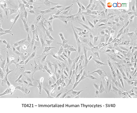 Immortalized Human Thyrocytes-SV40