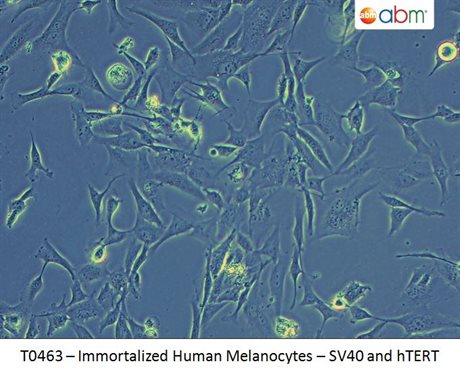 Immortalized Human Melanocytes-SV40 and hTERT