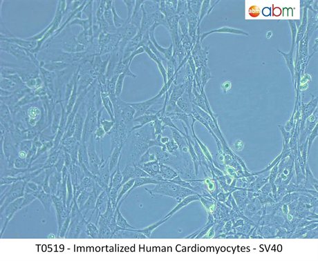 Immortalized Human Cardiomyocytes - SV40