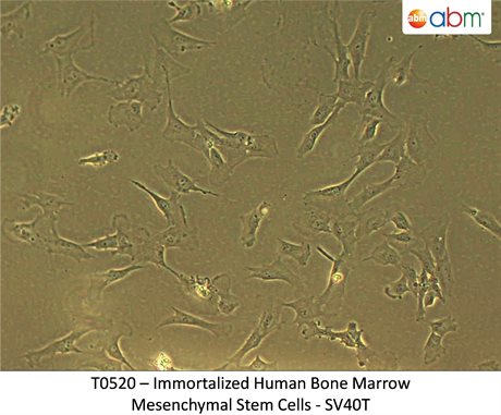 Immortalized Human Bone Marrow Mesenchymal Stem Cells SV40