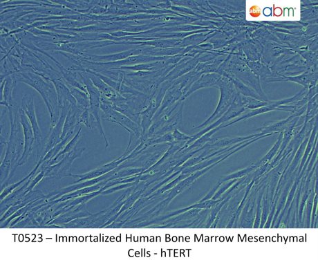 Immortalized Human Bone Marrow Mesenchymal Cells - hTERT