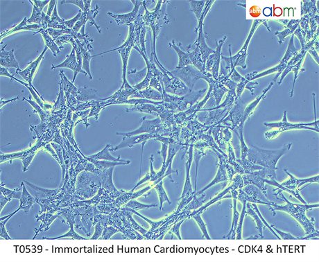 Immortalized Human Cardiomyocytes - CDK4, hTERT, & BMI