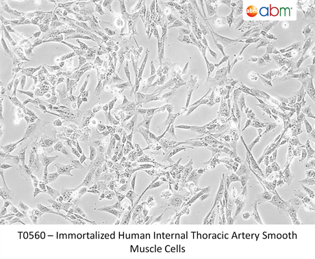Immortalized Human Internal Thoracic Artery Smooth Muscle Cells