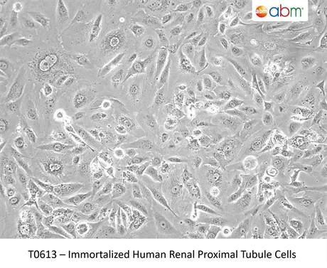 Immortalized Human Renal Proximal Tubule Cells