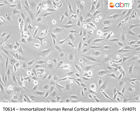 Immortalized Human Renal Cortical Epithelial Cells