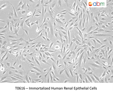 Immortalized Human Renal Epithelial Cells