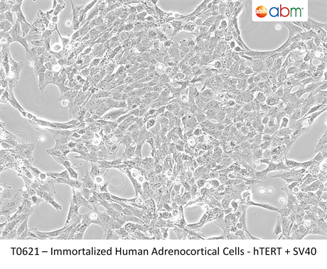 Immortalized Human Adrenocortical Cells- hTERT
