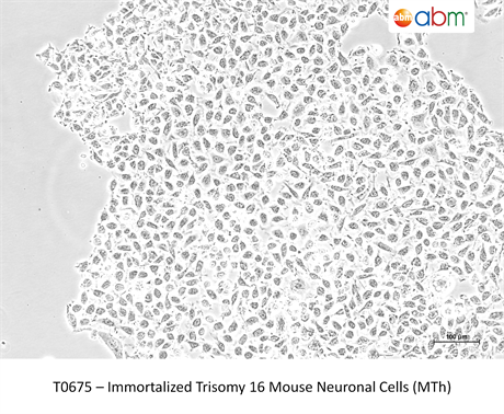 Immortalized Trisomy 16 Mouse Neuronal Cells (MTh)