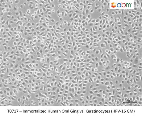 Immortalized Human Oral Gingival Keratinocytes (HPV-16 GM)