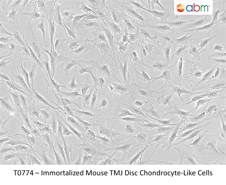 Immortalized Mouse TMJ Disc Chondrocyte-Like Cells