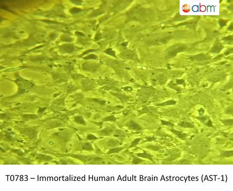 Immortalized Human Adult Brain Astrocytes (AST-1)
