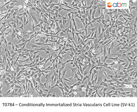 Conditionally Immortalized Stria Vascularis Cell Line (SV-k1)