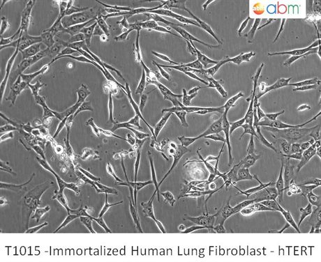 Immortalized Human Lung Fibroblast - hTERT
