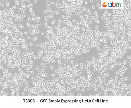 GFP Stably Expressing Hela Cell Line