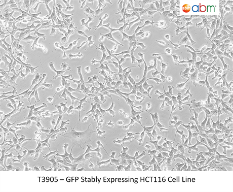GFP Stably Expressing HCT116 Cell Line