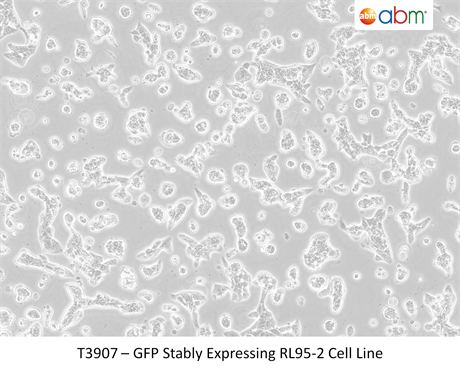 GFP Stably Expressing RL95-2 Cell Line