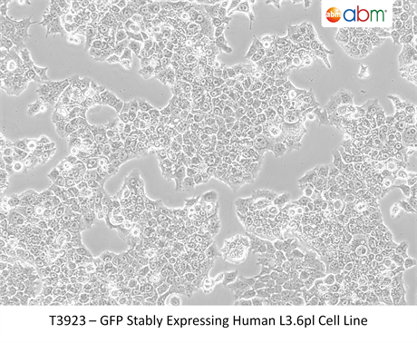 GFP Stably Expressing Human L3.6pl Cell Line