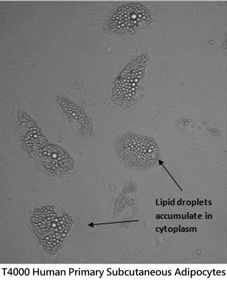 Human Primary Subcutaneous Adipocytes